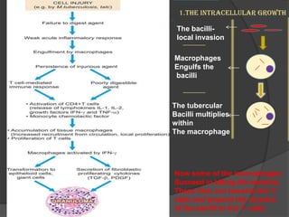 The bacilli-
local invasion
Macrophages
Engulfs the
bacilli
1.The intracellular growth
The tubercular
Bacilli multiplies
within
The macrophage
Now some of the macrophages
Succeed in killing the bacteria.
These then run towards the T-
cells and present the remains
of the bacilli to the T- cells
 