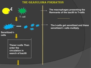 The Granuloma Formation
T- cell
The macrophages presenting the
Remnants of the bacilli to T-cells
Sensitized t-
cells
The t-cells get sensitized and these
sensitized t- cells multiply.
These t-cells Then
enter the
circulation in
search of bacilli
 