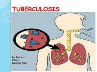 TUBERCULOSIS
Mr. Mahesh
Chand
Nursing Tutor
 