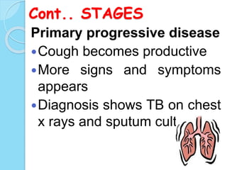 Cont.. STAGES
Primary progressive disease
Cough becomes productive
More signs and symptoms
appears
Diagnosis shows TB on chest
x rays and sputum culture
 