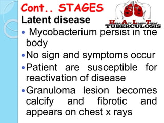 Cont.. STAGES
Latent disease
 Mycobacterium persist in the
body
No sign and symptoms occur
Patient are susceptible for
reactivation of disease
Granuloma lesion becomes
calcify and fibrotic and
appears on chest x rays
 