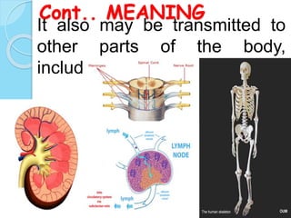 Cont.. MEANING
It also may be transmitted to
other parts of the body,
including the
 