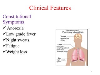 Clinical Features
Constitutional
Symptoms
 Anorexia
Low grade fever
Night sweats
Fatigue
Weight loss
15
 