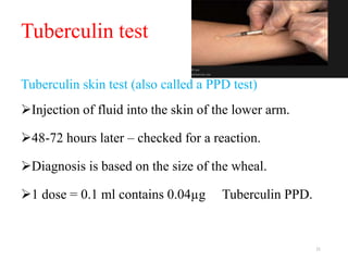 Tuberculin test
Tuberculin skin test (also called a PPD test)
Injection of fluid into the skin of the lower arm.
48-72 hours later – checked for a reaction.
Diagnosis is based on the size of the wheal.
1 dose = 0.1 ml contains 0.04µg Tuberculin PPD.
21
 