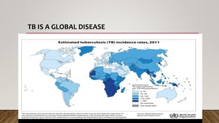 TB IS A GLOBAL DISEASE
 
