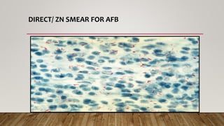 DIRECT/ ZN SMEAR FOR AFB
 