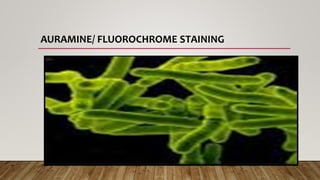 AURAMINE/ FLUOROCHROME STAINING
 