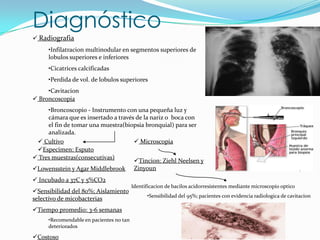 Diagnóstico
 Radiografia
     •Infilatracion multinodular en segmentos superiores de
     lobulos superiores e inferiores
     •Cicatrices calcificadas
     •Perdida de vol. de lobulos superiores
     •Cavitacion
 Broncoscopia
     •Broncoscopio - Instrumento con una pequeña luz y
     cámara que es insertado a través de la nariz o boca con
     el fin de tomar una muestra(biopsia bronquial) para ser
     analizada.
  Cultivo                            Microscopia
 Especimen: Esputo
 Tres muestras(consecutivas)
                                     Tincion: Ziehl Neelsen y
Lowensstein y Agar Middlebrook Zinyoun
 Incubado a 37C y 5%CO2
                                         Identificacion de bacilos acidorresistentes mediante microscopio optico
Sensibilidad del 80%; Aislamiento
                                               •Sensibilidad del 95%; pacientes con evidencia radiologica de cavitacion
selectivo de micobacterias
Tiempo promedio: 3-6 semanas
     •Recomendable en pacientes no tan
     deteriorados

Costoso
 