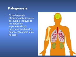 • El bacilo puede
alcanzar cualquier parte
del cuerpo, incluyendo
las porciones
superiores de los
pulmones (también los
riñones, el cerebro y los
huesos)
Patogénesis
 