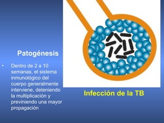 • Dentro de 2 a 10
semanas, el sistema
inmunológico del
cuerpo generalmente
interviene, deteniendo
la multiplicación y
previniendo una mayor
propagación
Patogénesis
Infección de la TB
 