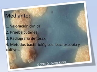 Mediante:
1. Valoración clínica.
2. Prueba cutánea.
3. Radiografía de tórax.
4. Métodos bacteriológicos: baciloscopia y
cultivos.

 