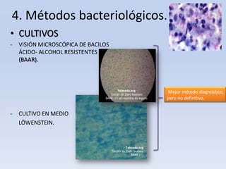 4. Métodos bacteriológicos.
• CULTIVOS
-

VISIÓN MICROSCÓPICA DE BACILOS
ÁCIDO- ALCOHOL RESISTENTES
(BAAR).

Mejor método diagnóstico,
pero no definitivo.

-

CULTIVO EN MEDIO
LÖWENSTEIN.

 