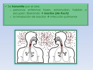  Se transmite por el aire:
o personas enfermas tosen, estornudan, hablan o
escupen, liberando  bacilos (de Koch)
o la inhalación de bacilos  infección pulmonar

 
