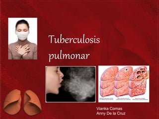 Tuberculosis 
pulmonar 
Vianka Comas 
Anny De la Cruz 
 