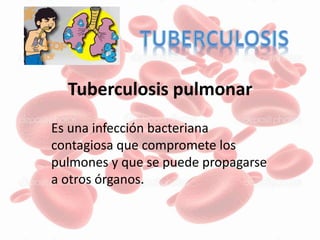 Tuberculosis pulmonar
Es una infección bacteriana
contagiosa que compromete los
pulmones y que se puede propagarse
a otros órganos.
 