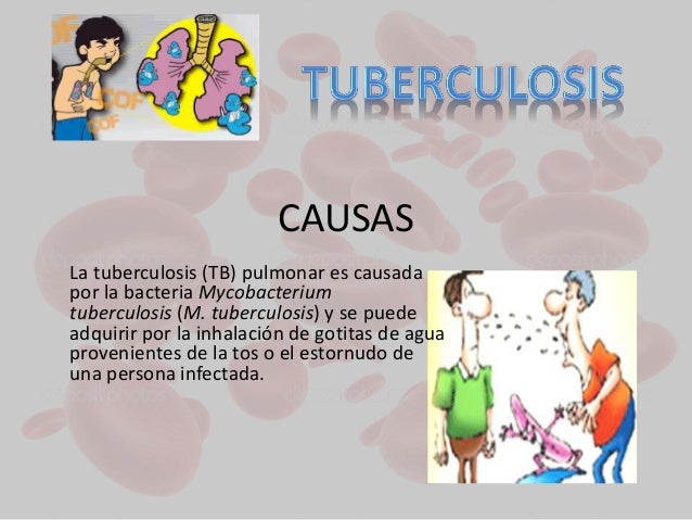 Resultado de imagen para causas de la tuberculosis pulmonar