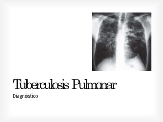 TuberculosisPulmonar