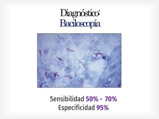 Diagnóstico:
Baciloscopía