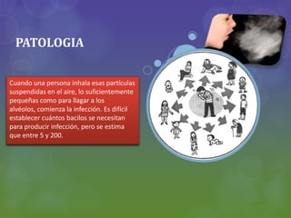 PATOLOGIA
Cuando una persona inhala esas partículas
suspendidas en el aire, lo suficientemente
pequeñas como para llagar a los
alvéolos, comienza la infección. Es difícil
establecer cuántos bacilos se necesitan
para producir infección, pero se estima
que entre 5 y 200.
 