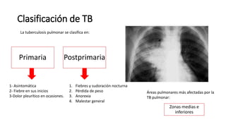 Clasificación de TB
Primaria Postprimaria
La tuberculosis pulmonar se clasifica en:
1. Fiebres y sudoración nocturna
2. Pérdida de peso
3. Anorexia
4. Malestar general
Áreas pulmonares más afectadas por la
TB pulmonar:
Zonas medias e
inferiores
1- Asintomática
2- Fiebre en sus inicios
3-Dolor pleurítico en ocasiones.
 