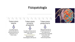 Fisiopatología
 