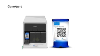Genexpert
 