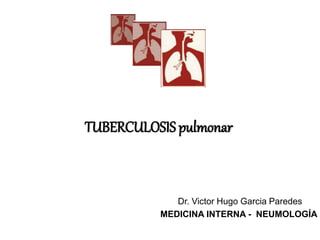 TUBERCULOSIS pulmonar
Dr. Victor Hugo Garcia Paredes
MEDICINA INTERNA - NEUMOLOGÍA
 