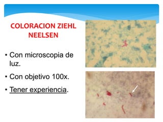 COLORACION ZIEHL
NEELSEN
• Con microscopia de
luz.
• Con objetivo 100x.
• Tener experiencia.
 