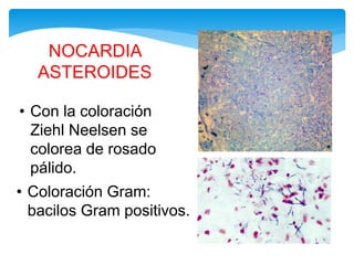 NOCARDIA
ASTEROIDES
• Con la coloración
Ziehl Neelsen se
colorea de rosado
pálido.
• Coloración Gram:
bacilos Gram positivos.
 