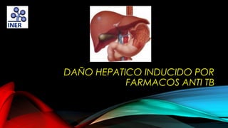 DAÑO HEPATICO INDUCIDO POR
FARMACOS ANTI TB

 