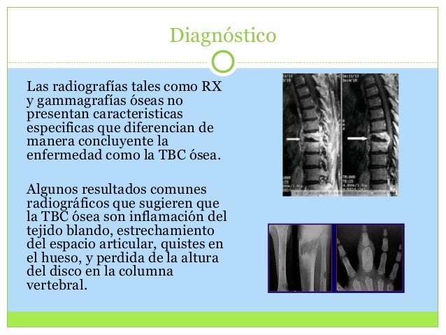 El yoga como la terapia del dolor en el cuello