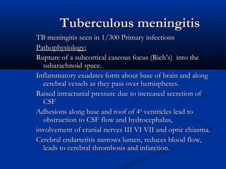 Tuberculosis seminar.