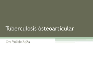 Tuberculosis ósteoarticular
Dra Vallejo R3Rx
 