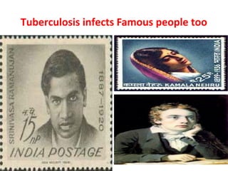 Tuberculosis infects Famous people too
Dr.T.V.Rao MD 15
 