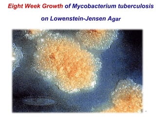 Eight Week Growth of Mycobacterium tuberculosis
on Lowenstein-Jensen Agar
Dr.T.V.Rao MD 28
 