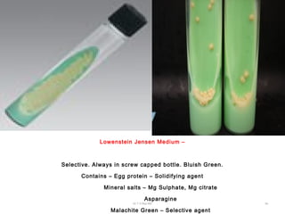 Lowenstein Jensen Medium –
Selective. Always in screw capped bottle. Bluish Green.
Contains – Egg protein – Solidifying agent
Mineral salts – Mg Sulphate, Mg citrate
Asparagine
Malachite Green – Selective agent
Dr.T.V.Rao MD 34
 
