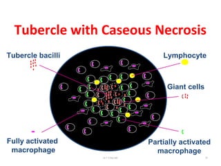 Tubercle with Caseous Necrosis
Giant cells
Tubercle bacilli
Partially activated
macrophage
Lymphocyte
Fully activated
macrophage
Dr.T.V.Rao MD 57
 