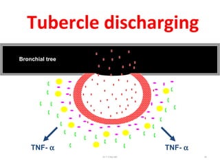 Tubercle discharging
Bronchial tree
TNF- αTNF- α
Dr.T.V.Rao MD 60
 