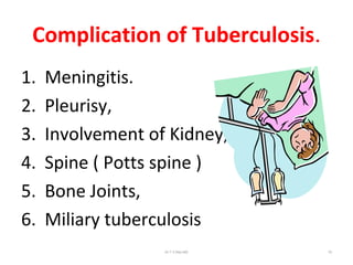 Complication of Tuberculosis.
1. Meningitis.
2. Pleurisy,
3. Involvement of Kidney,
4. Spine ( Potts spine )
5. Bone Joints,
6. Miliary tuberculosis
Dr.T.V.Rao MD 72
 