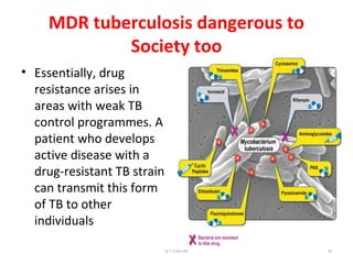 MDR tuberculosis dangerous to
Society too
• Essentially, drug
resistance arises in
areas with weak TB
control programmes. A
patient who develops
active disease with a
drug-resistant TB strain
can transmit this form
of TB to other
individuals
Dr.T.V.Rao MD 80
 
