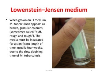 Lowenstein–Jensen medium
• When grown on LJ medium,
M. tuberculosis appears as
brown, granular colonies
(sometimes called "buff,
rough and tough"). The
media must be incubated
for a significant length of
time, usually four weeks,
due to the slow doubling
time of M. tuberculosis
Dr.T.V.Rao MD 90
 