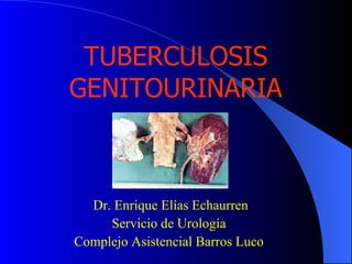 TUBERCULOSIS GENITOURINARIA Dr. Enrique Elías Echaurren Servicio de Urología  Complejo Asistencial Barros Luco  