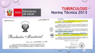 TUBERCULOSIS
Norma Técnica 2013
 