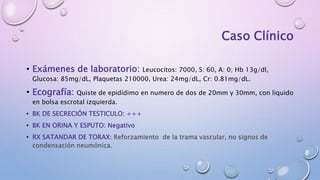 Caso Clínico
• Exámenes de laboratorio: Leucocitos: 7000, S: 60, A: 0; Hb 13g/dl,
Glucosa: 85mg/dL, Plaquetas 210000, Urea: 24mg/dL, Cr: 0.81mg/dL.
• Ecografía: Quiste de epidídimo en numero de dos de 20mm y 30mm, con liquido
en bolsa escrotal izquierda.
• BK DE SECRECIÓN TESTICULO: +++
• BK EN ORINA Y ESPUTO: Negativo
• RX SATANDAR DE TORAX: Reforzamiento de la trama vascular, no signos de
condensación neumónica.
 