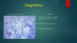 Diagnóstico
Baciloscopia directa Cultivo
 Lowenstein – Jensen y Ogawa:
Especificidad 99% 6 semana.
 BACTEC demora 3 semanas
 PCR demora 1 semana
 