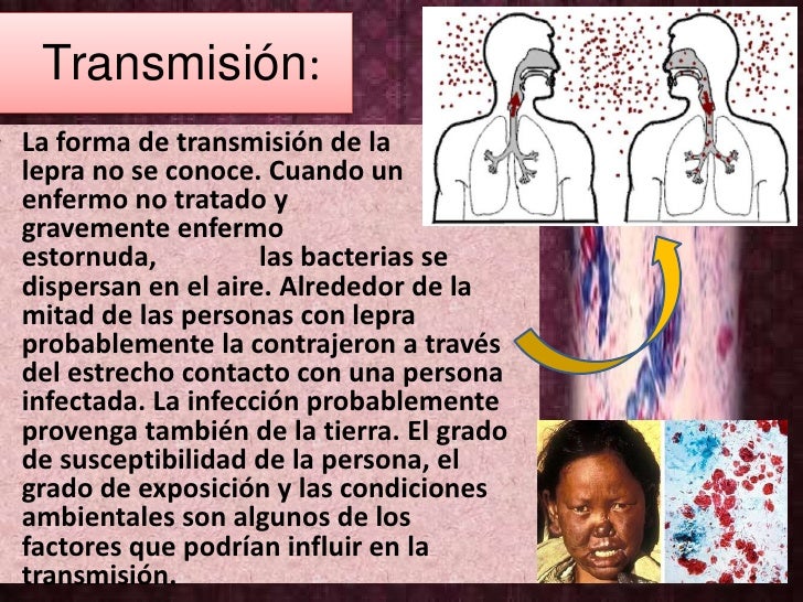 La codificación del alcoholismo en sankt-peterburge las direcciones