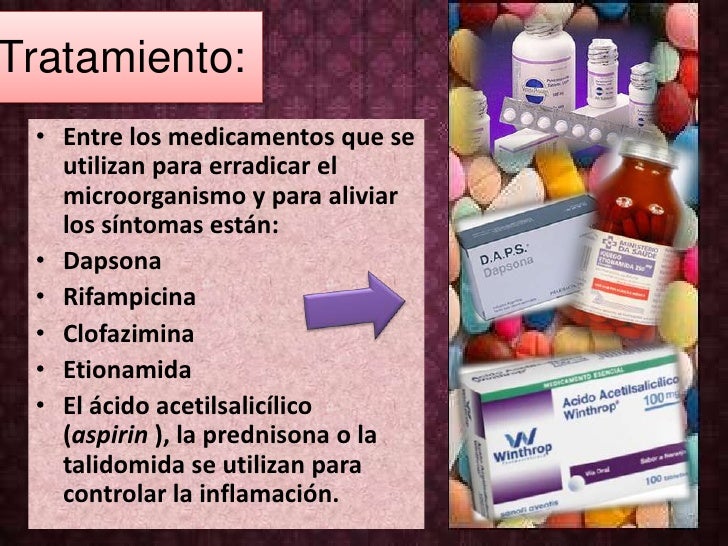 Medicamento para dolor de pies Medicamento para dolor de pies