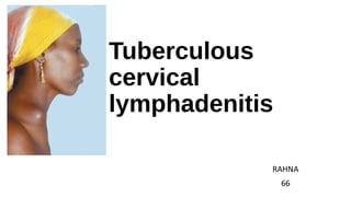 Tuberculous
cervical
lymphadenitis
RAHNA
66
 
