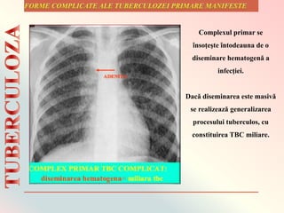Complexul primar se
însoţeşte întodeauna de o
diseminare hematogenă a
infecţiei.
Dacă diseminarea este masivă
se realizează generalizarea
procesului tuberculos, cu
constituirea TBC miliare.
 