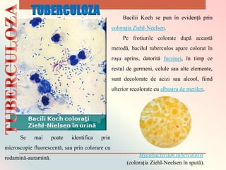 Bacilii Koch se pun în evidență prin
colorația Ziehl-Neelsen.
Pe frotiurile colorate după această
metodă, bacilul tuberculos apare colorat în
roșu aprins, datorită fucsinei, în timp ce
restul de germeni, celule sau alte elemente,
sunt decolorate de acizi sau alcool, fiind
ulterior recolorate cu albastru de metilen.
Mycobacterium tuberculosis
(colorația Ziehl-Neelsen în spută).
Se mai poate identifica prin
microscopie fluorescentă, sau prin colorare cu
rodamină-auramină.
TUBERCULOZA
 